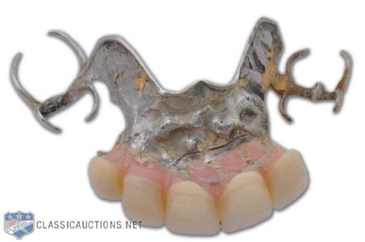 Ted Kennedys Partial Dental Plate